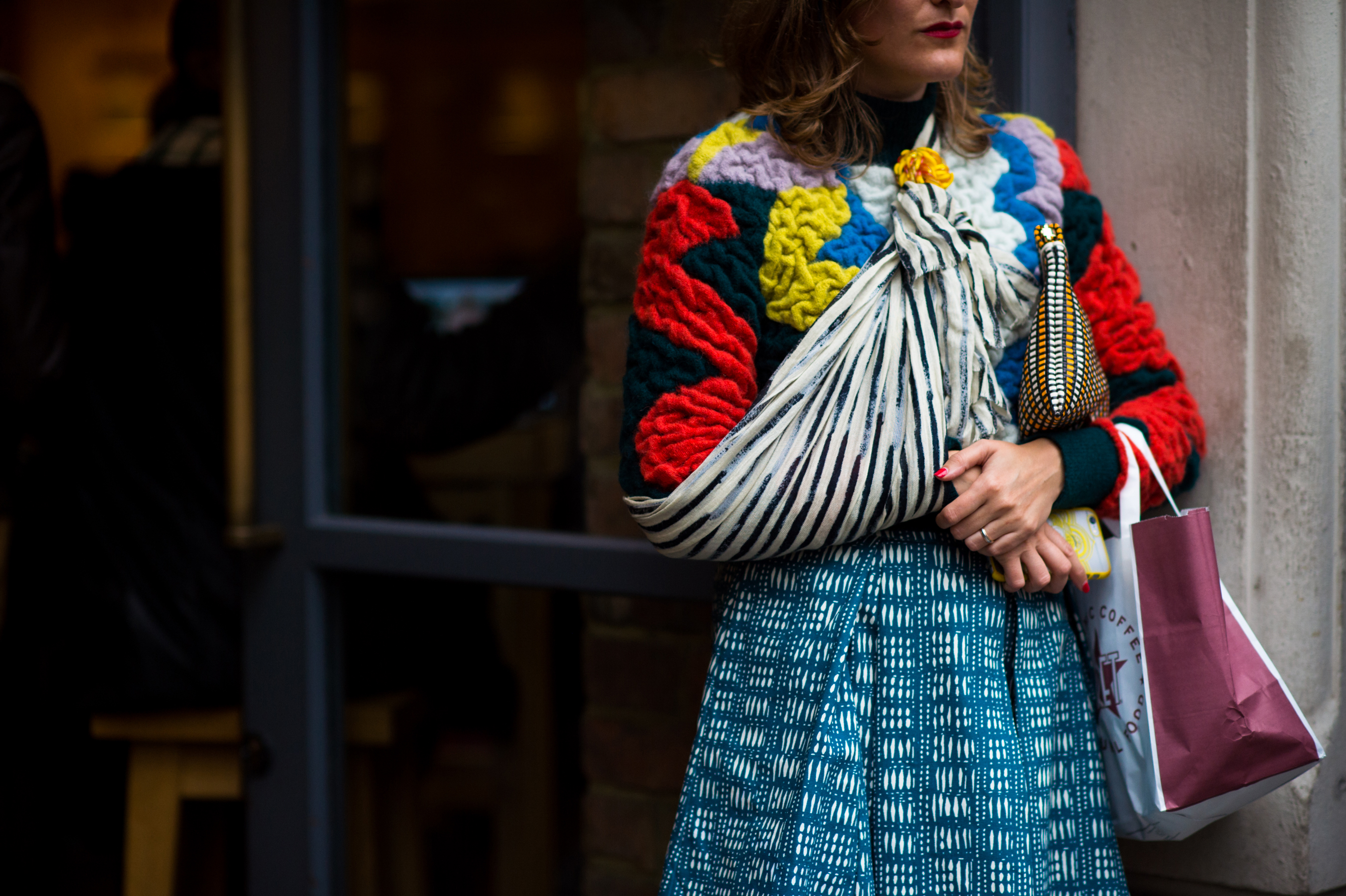 Woman with broken hand wearing vintage outfit