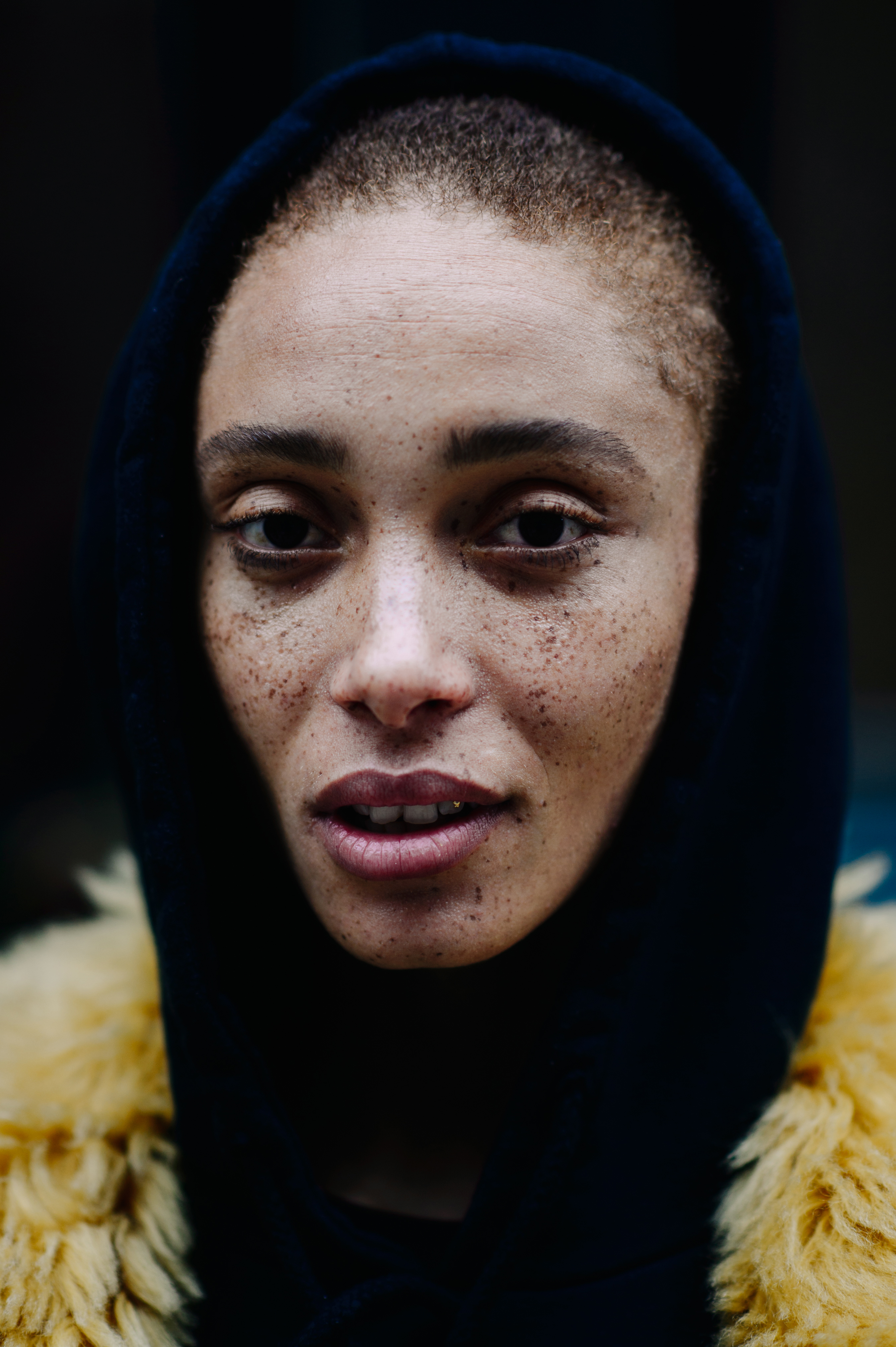 Portarait of a model with freckles