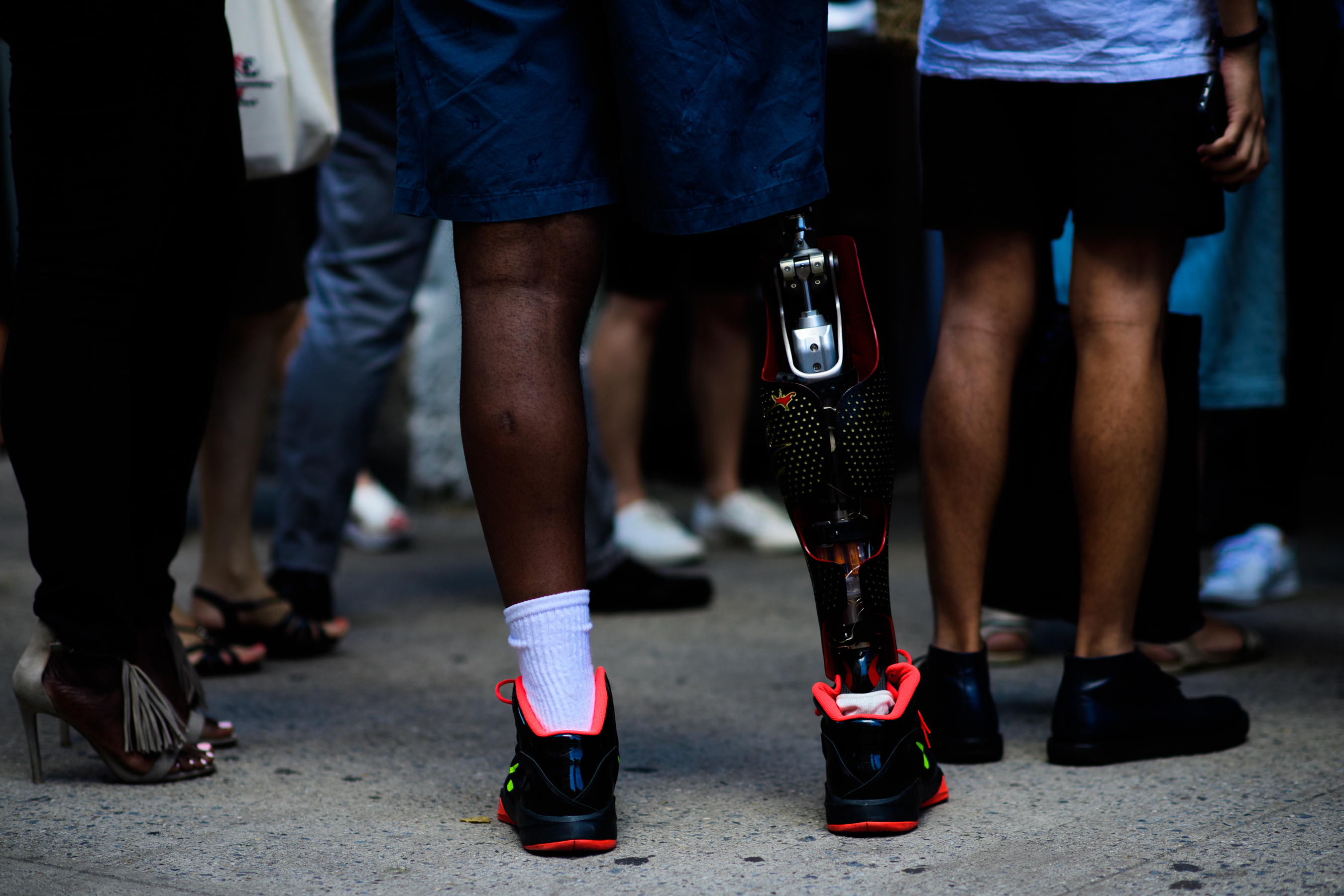 Man with customised prosthetic leg