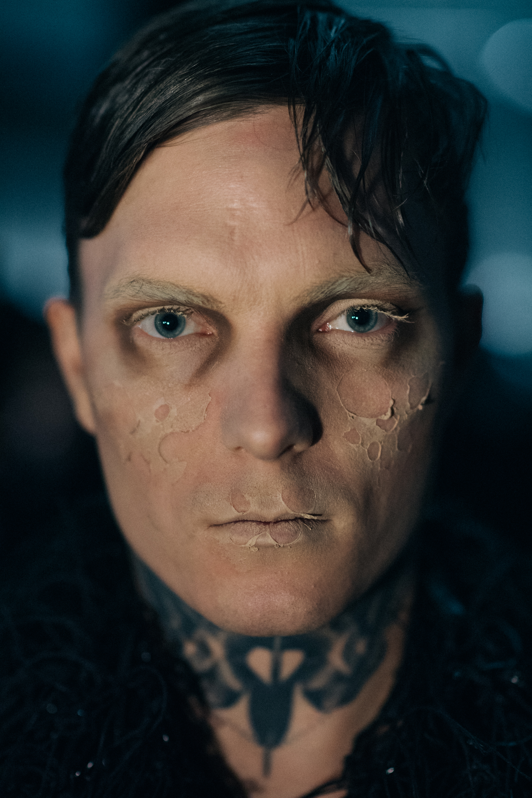 Portrait of a male model damaged skin